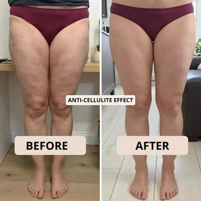 POWERSHORTS™ | 3D Metabolic Booster Shorts