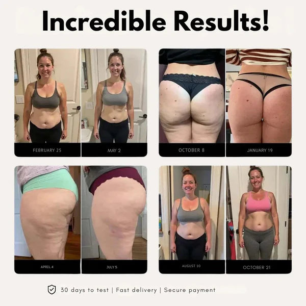 POWERSHORTS™ | 3D Metabolic Booster Shorts