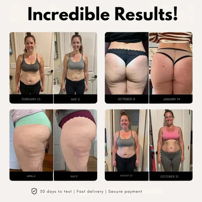 POWERSHORTS™ | 3D Metabolic Booster Shorts